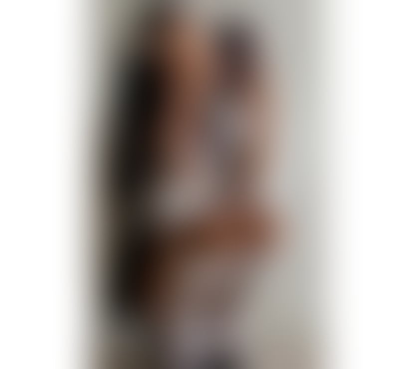 Escorts West Midlands Birmingham - Photos for ♥️KYLIE 🍭STUNNING BABE🍭InCall&OutCall☎️