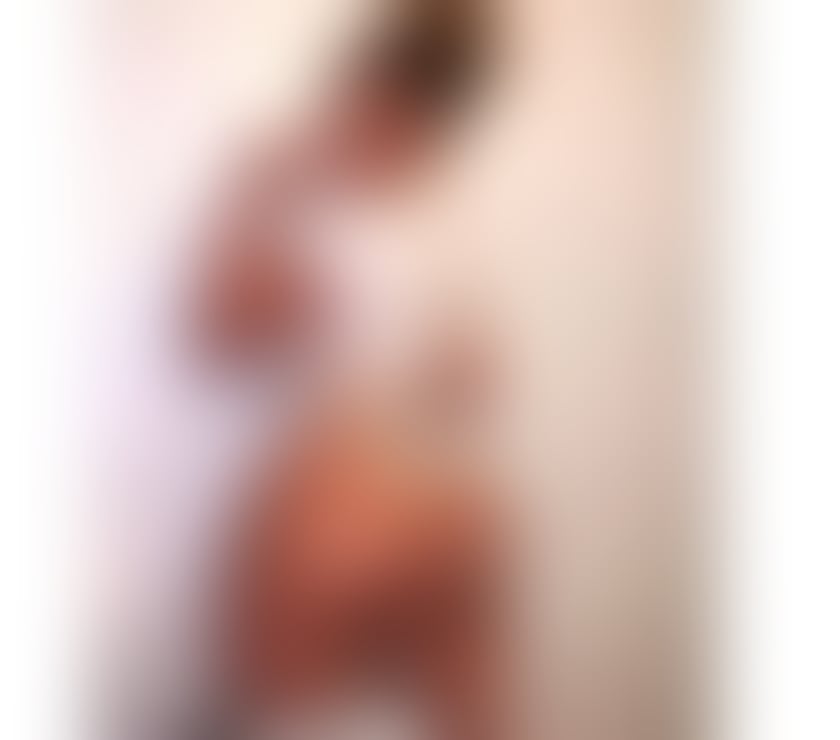 Escorts Hertfordshire Welwyn Hatfield - Photos for 🍆Hot Melanie New in The UK! Best Satisfaction🫦