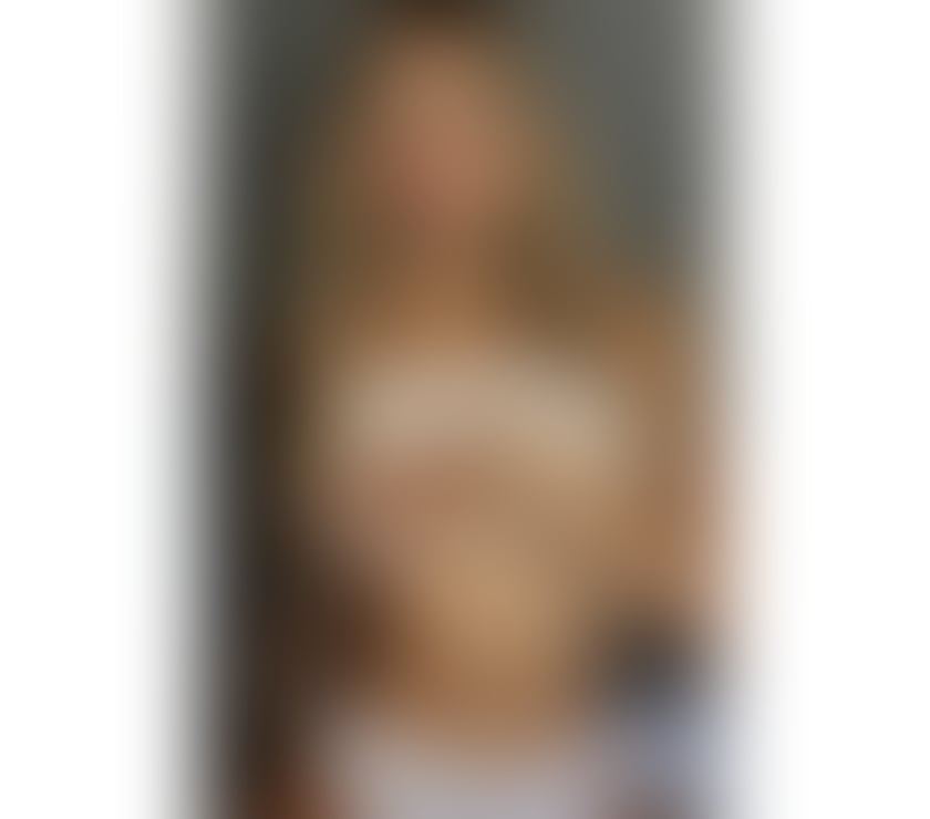 Escorts Essex Brentwood - Photos for MEL 🍯 BRAZILIAN 🆕 PARTY GIRL 🥳