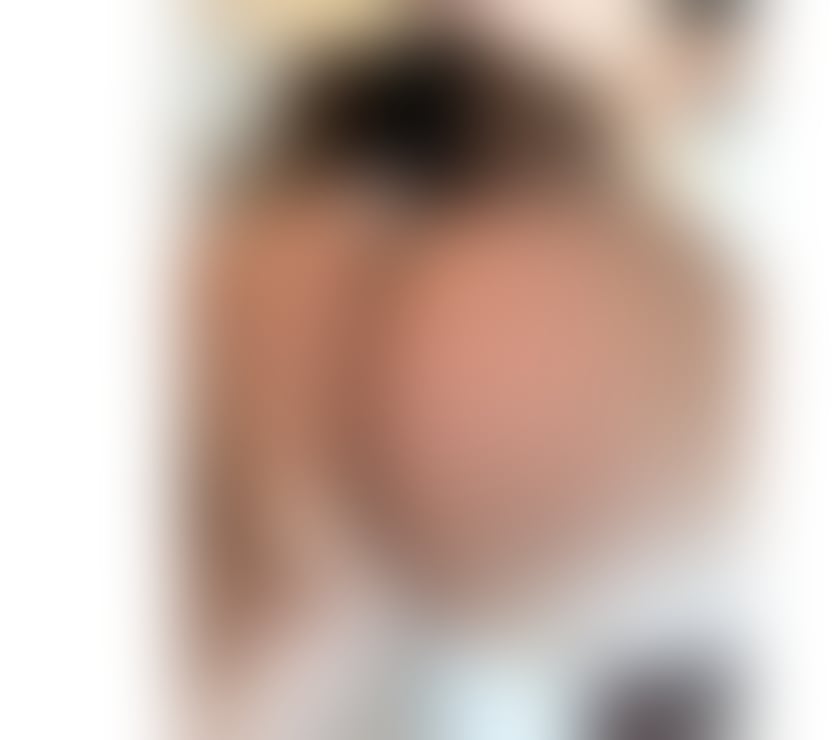 Escorts South East London Peckham - South East London - Photos for THE BEST SERVICE & NO RUSH 🍑🔥‼️