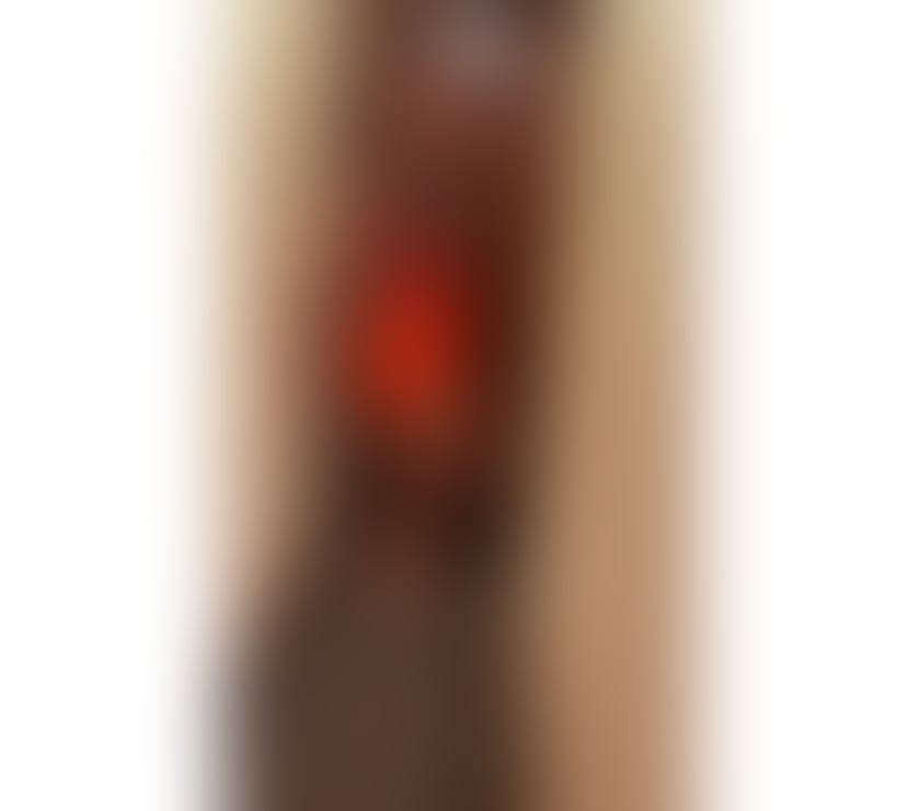 Escorts East London Hackney - East London - Photos for NEW IN TOWN❗️❗️ SKINNY