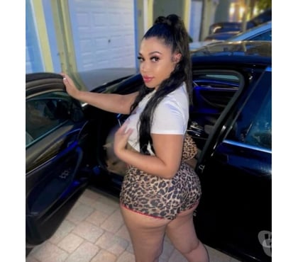 Escorts Wallsend North Tyneside - Photos for GIRL ON FIRE THE BEST BJ 🫦🫦