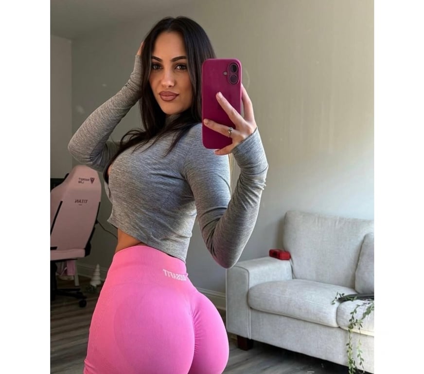 Escorts West Midlands Birmingham - Photos for HOT BABY 🔥 BRAZILIAN 🔥 BEST Service