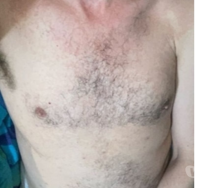  Gay massage County Durham Blackhill - County Durham - Photos for meetswithmen411