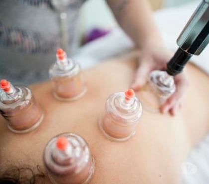 Massage Doncaster City Centre Doncaster - Photos for Winter Sale! Massage, Acupuncture, and Cupping - Relax with