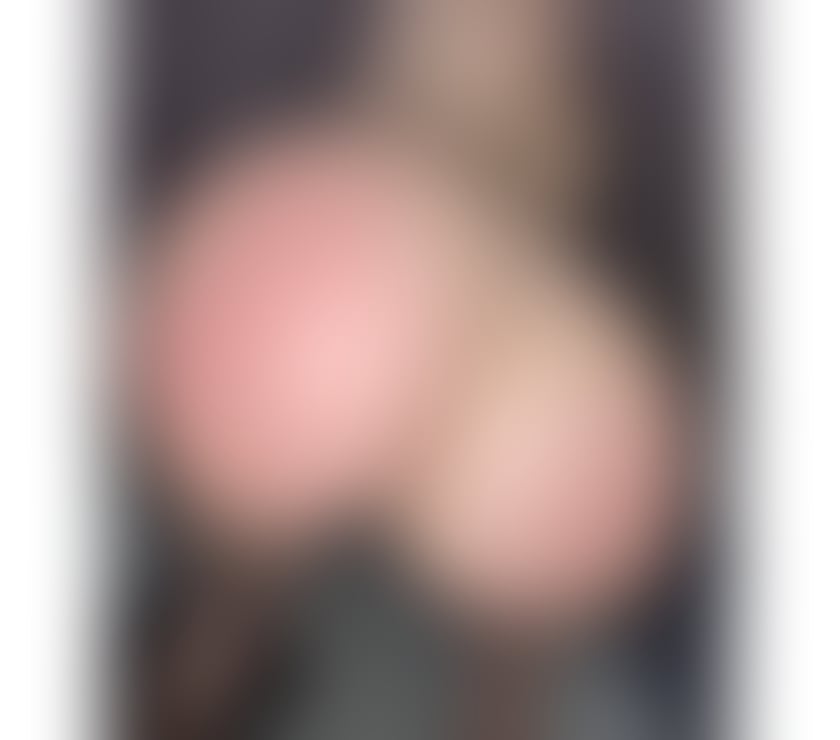 Escorts Smithills Bolton - Photos for ON FIRE 🔥 FOR YOU 🎉🎉🎉💋