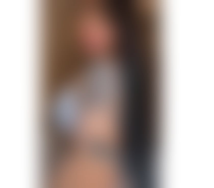 Escorts Kent Thanet - Photos for AnneParty🎉 🩷💐100% Genuine💕 Brazilian🇧🇷