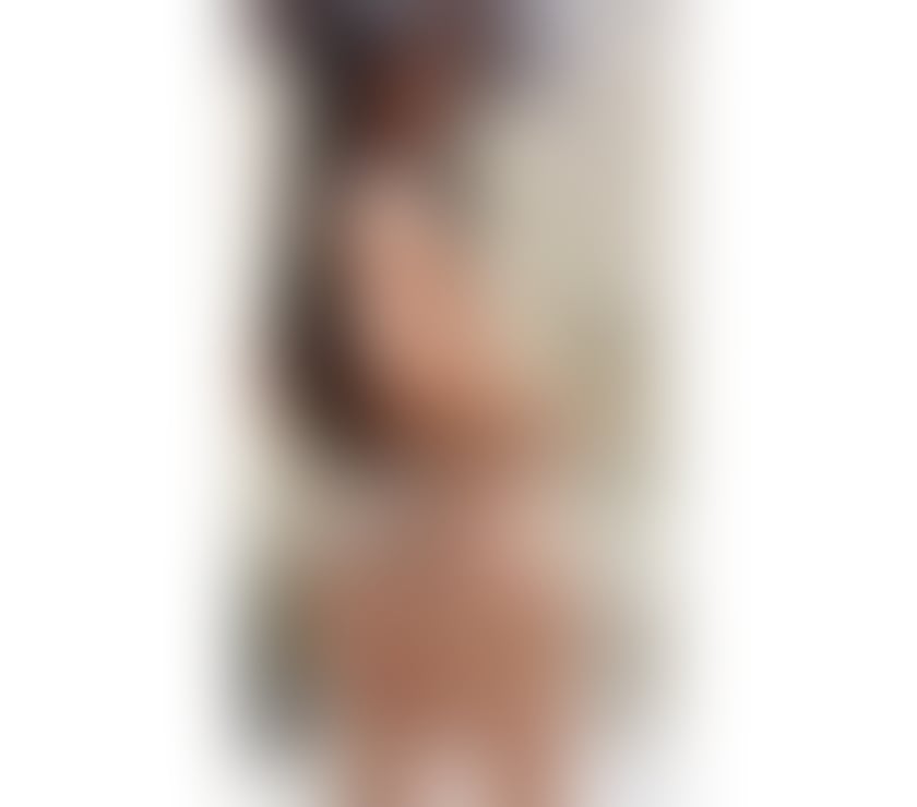 Escorts Kent Dartford - Photos for EMMA 💋 NEW IN TOWN 💯 JUST ONE WEEK🔥