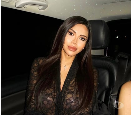 Escorts and Massages Bridgtown Cannock Chase - Photos for NEW IN TOWN💋 OUT CALL IN CALL📞 ☎️ REAL PICTURES