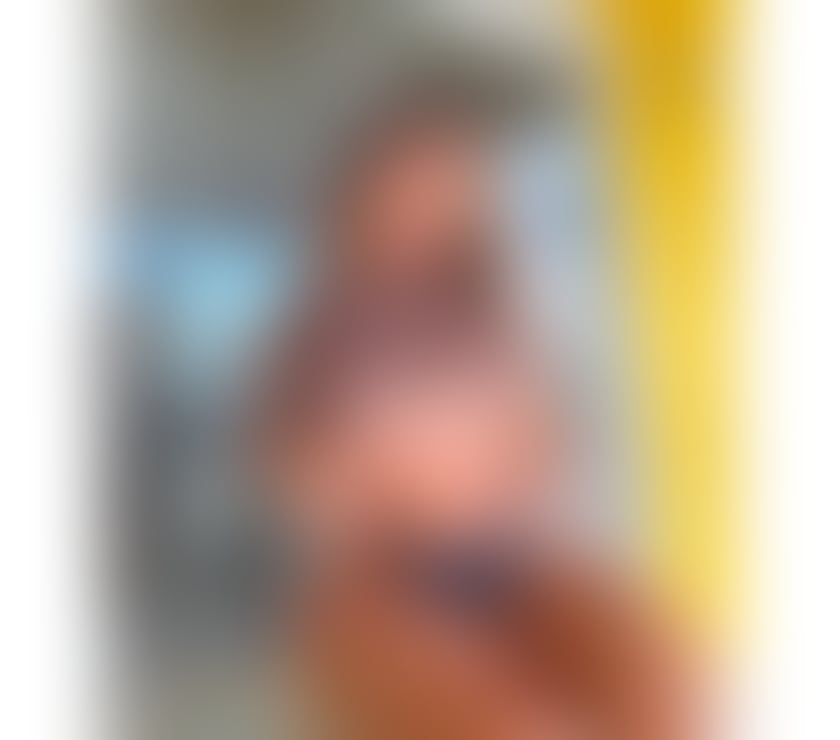 Escorts Lincolnshire North East Lincolnshire - Photos for 💚💛TROPICAL CANDY JESS 💚💛