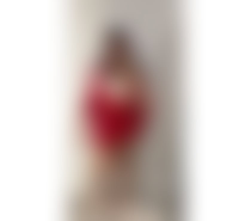 Escorts Somerset North Somerset - Photos for 🔥SWEET FABY PARTY GIRL 🔥