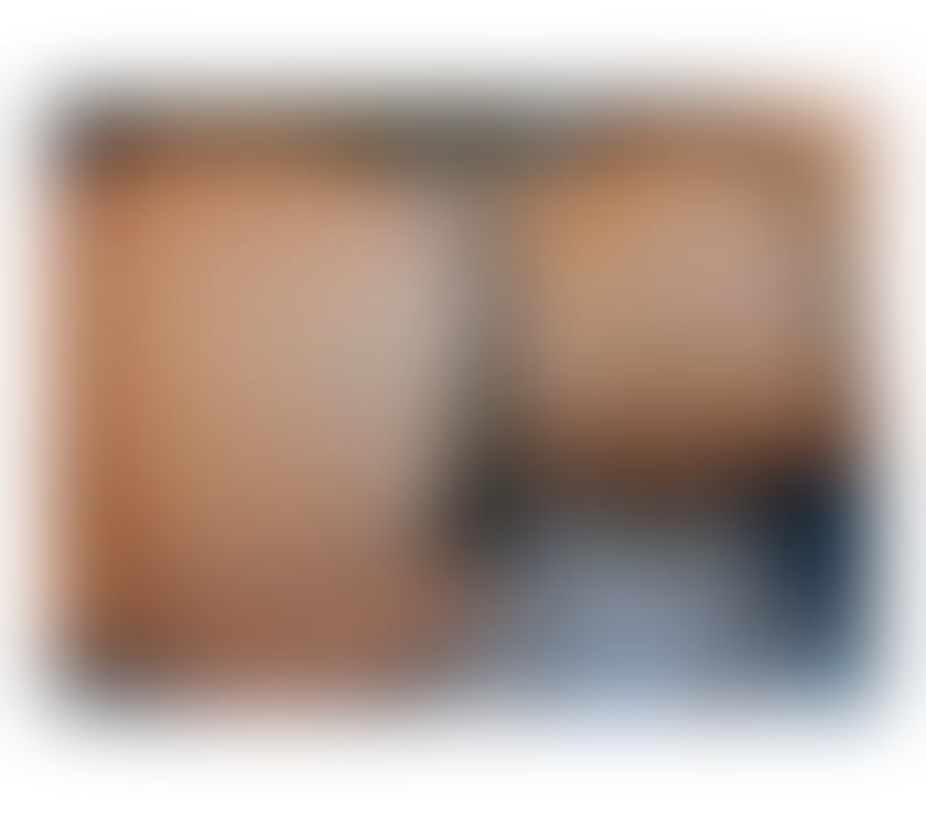 Escorts Hertfordshire Welwyn Hatfield - Photos for 🧨NEW HERE 💯REAL💎Party girl💎☎️☎️