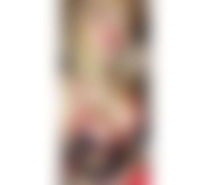 Trans Escorts Central London Westminster - Central London - Photos for NEW Experience:POSTOTRANSWOMAN 🐈‍⬛ 🐸 🐈