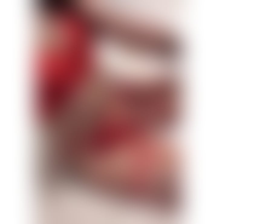 Escorts Kent Thanet - Photos for 🇧🇷NEW BABI PARTY GIRL 👅