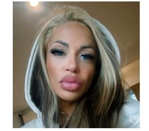 🍒🍓Strawberry 🍓