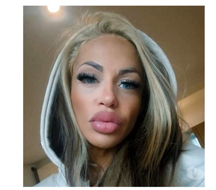 Escorts Hackney East London - Photos for 🍒🍓Strawberry 🍓