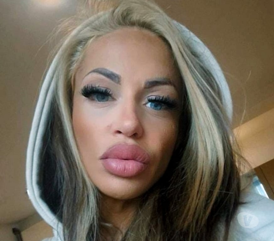 Escorts East London Dalston - East London - Photos for 🍓🍓Strawberry 🍓 🍓