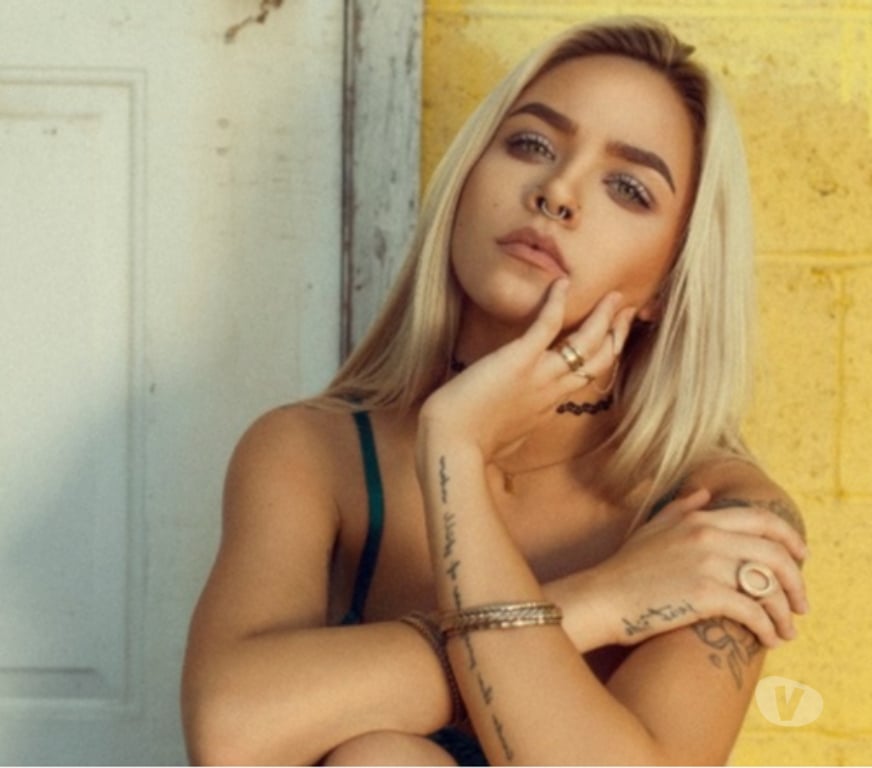 Escorts North West London Baker Street - North West London - Photos for HIGH CLASS 🍾 1 WEEK IN LONDON 🍾