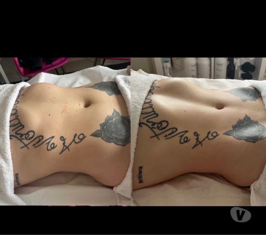 Full body massage Kent Gravesham - Photos for Independent Relax and forget your sorrow