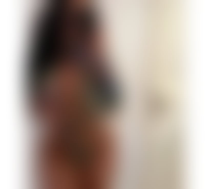 Escorts Dundee Dundee City Centre - Dundee - Photos for ❤️‍🔥EVY❤️‍🔥FULL GFE💯HOT MASSAGE🔥