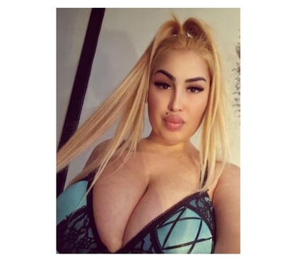  Escorts Derby City Centre Derby - Photos for 🍓 😍💕⭐💖New SWEET GIRL OUTCALL ONLY !!!🍓