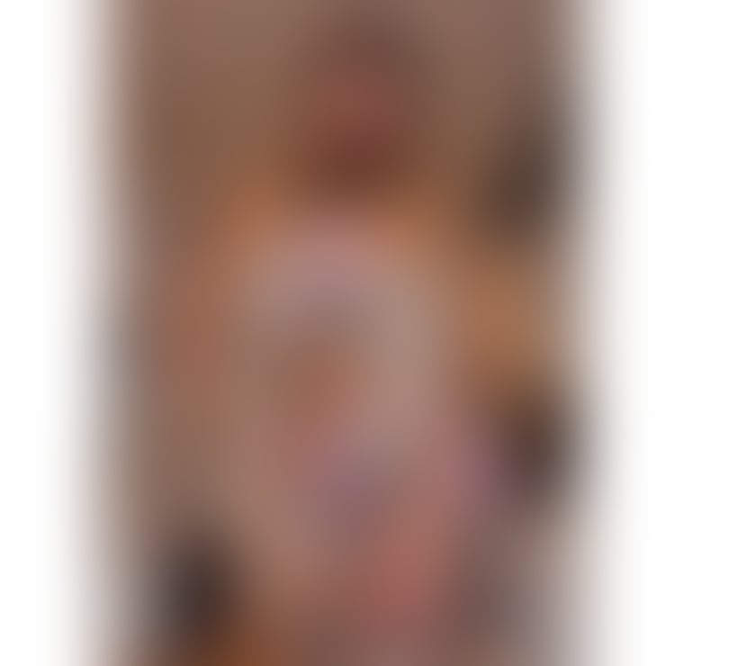 Escorts Norfolk Great Yarmouth - Photos for 💋🔥🔥Brazilian is back in town, hot girl