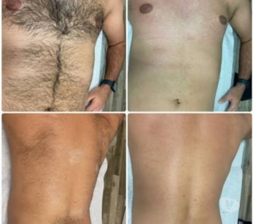 Health-Beauty East London Havering - Photos for Waxing for both Male & Female- full body, Hollywood waxing