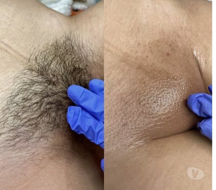 Health-Beauty Mawneys Havering - Photos for Waxing for both Male & Female- full body, Hollywood waxing