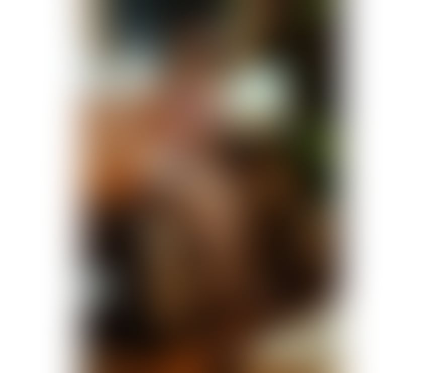 Trans Escorts Edinburgh Edinburgh Old Town - Edinburgh - Photos for TS YARA MARQUESA🧿NEW IN EDINBURGH