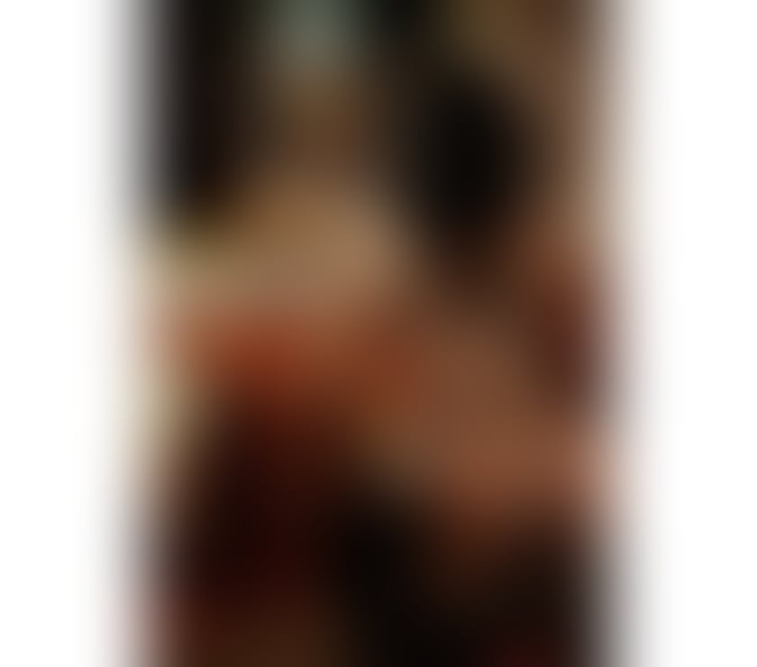 Trans Escorts Edinburgh Edinburgh Old Town - Edinburgh - Photos for TS YARA MARQUESA🧿NEW IN EDINBURGH