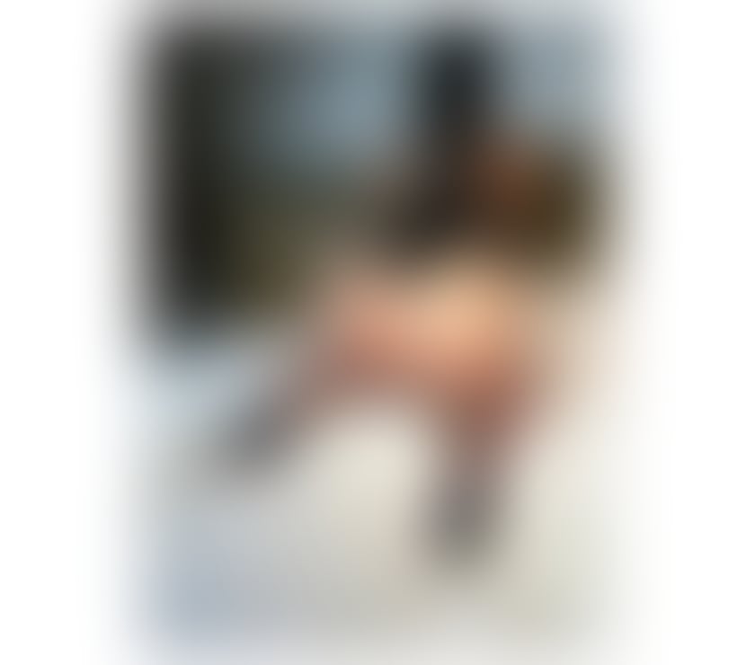 Escorts Fife Dysart - Fife - Photos for 💙💙NOW IN TOWN🔥BEST SERVICE😘NO RUSH