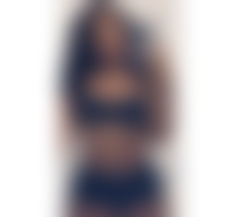 Escorts South East London Forest Hill - South East London - Photos for 🍒 SENSUAL & PASSIONATE MAMI 🍒🔥🔥