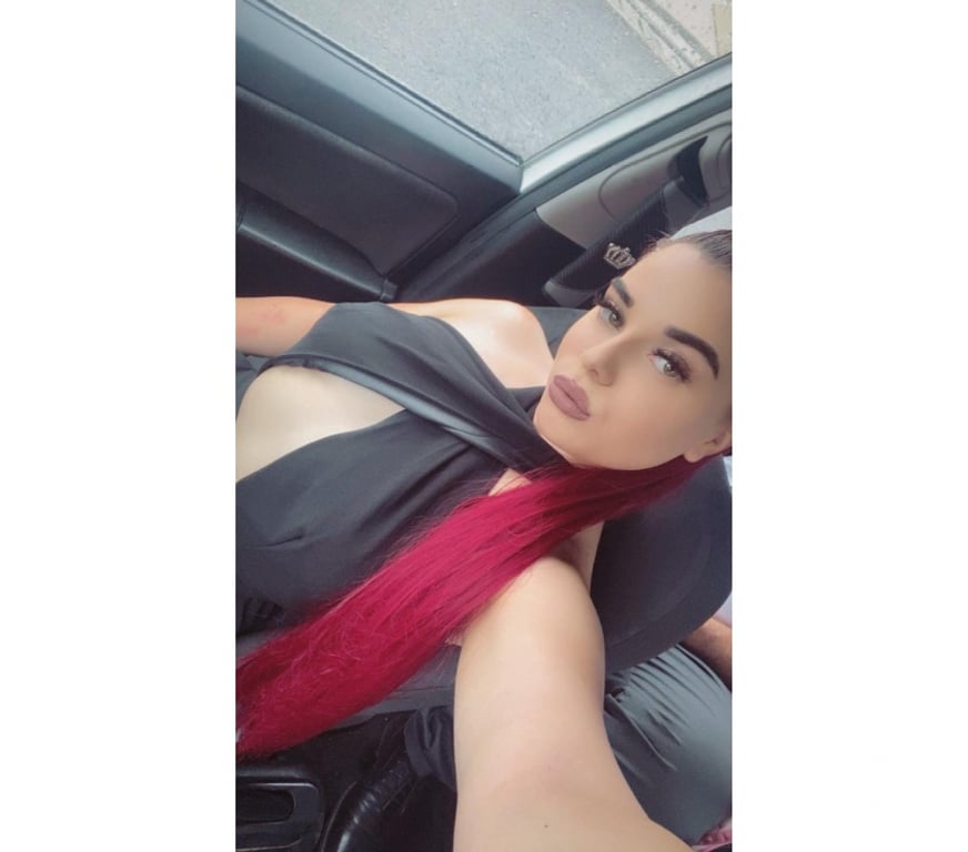 Escorts West Midlands Birmingham - Photos for AGNES11❤️ NEW IN TOWN✨ 100% REAL💯