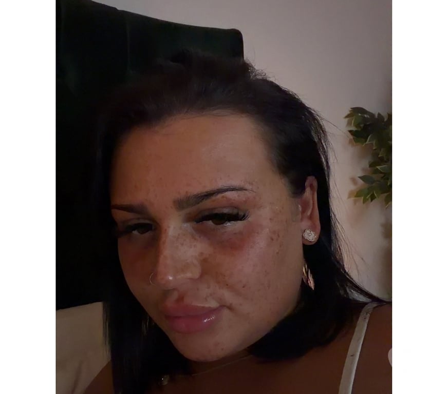 Escorts Glasgow Glasgow City Centre - Glasgow - Photos for Hot Scottish Brunette Scarlett Foxx💋