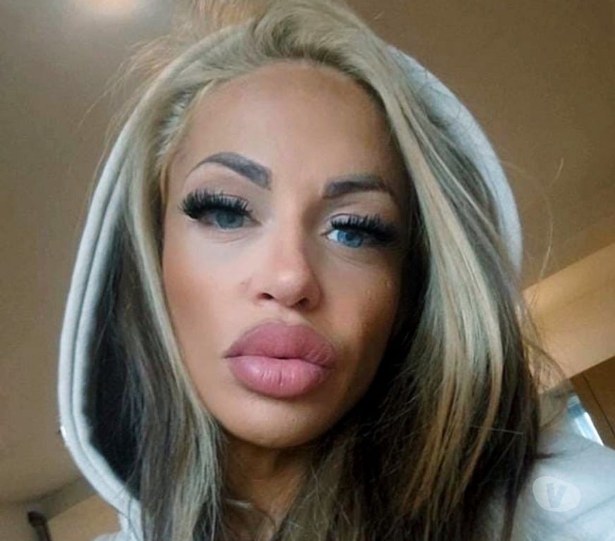 Escorts North London Stoke Newington - North London - Photos for 🍓🍓Strawberry 🍓🍓