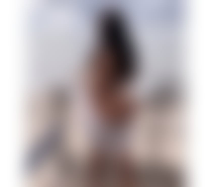 Escorts Erdington Birmingham - Photos for 🍑YARI EXOTIC LATINA NO RUSH SERVICE 🍑