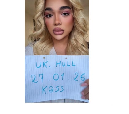  Escorts Hull City Centre Hull - Photos for 💕Kass Sexy TGirlll 🙈 Gros cul et une surprise☺️