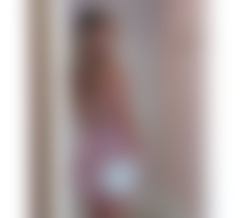 Escorts Surrey Guildford - Photos for BIANCA ✨ FIRT IN TOWN 🥂 NO RUSH ✨