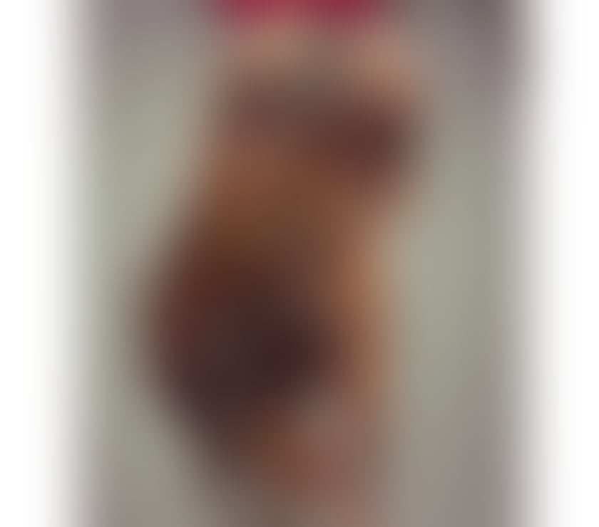 Escorts Bexley Erith - Bexley - Photos for 💋YOUNG & BEAUTIFUL- NEW IN TOWN 💋 CALL ME