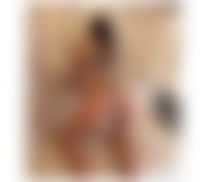 Escorts Lancashire Blackburn with Darwen - Photos for HELLO I M LAURA BEST SERVICE FOR YOU