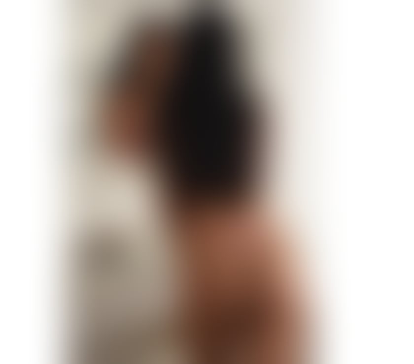 Escorts Hull Brighton Street Industrial Estate - Hull - Photos for Rose brazilian Party girl🍾