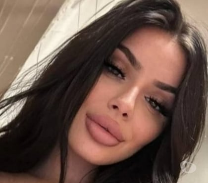  Escorts Colchester City Centre Colchester - Photos for New T-day arrived in UK Molly 24h in&out no deposit