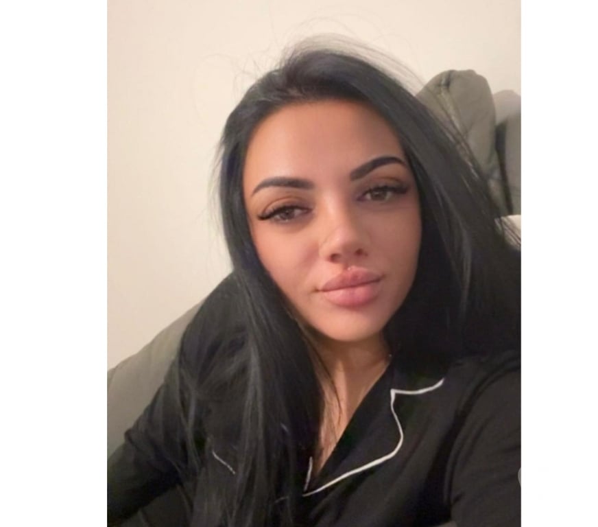 Escorts North Yorkshire Ripon - North Yorkshire - Photos for GiuliA NEW IN TOWN♥️BEST SERVICE