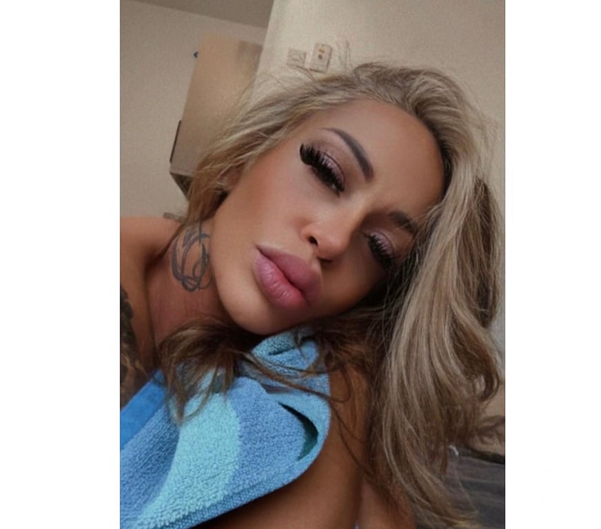 Escorts East London Hackney - East London - Photos for 🍒🔥Cherry🍒🔥🍒🔥