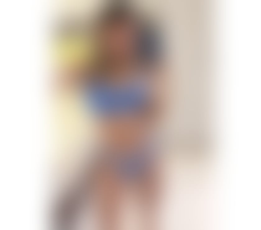 Escorts West Midlands Birmingham - Photos for Lunna Fortunatto 💋 NEW IN TOWN ❤️‍🔥