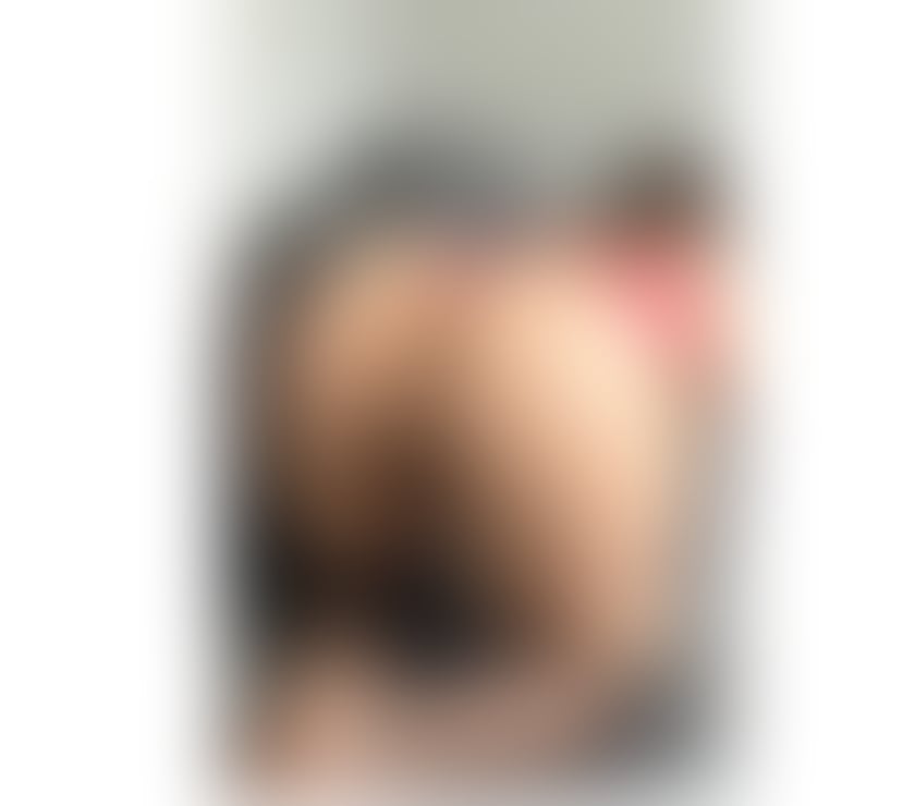 Escorts Kent Dartford - Photos for 🔥Bruna New Girl, Love Party, GFE🔥24 hours📞