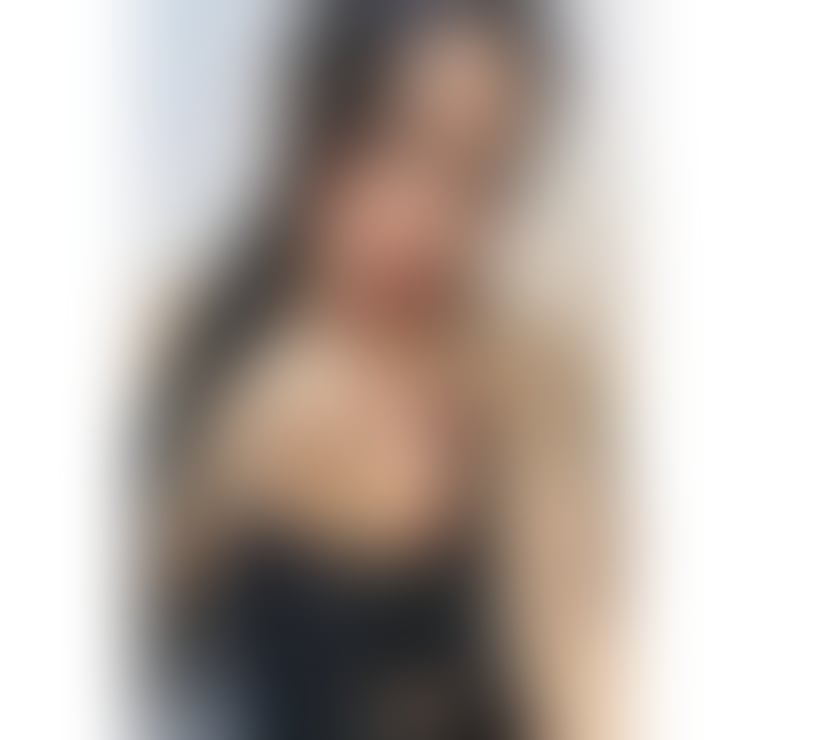 Escorts Kent Medway - Kent - Photos for SEXY 🌹NEW FACE 🔥BEST SERVICE