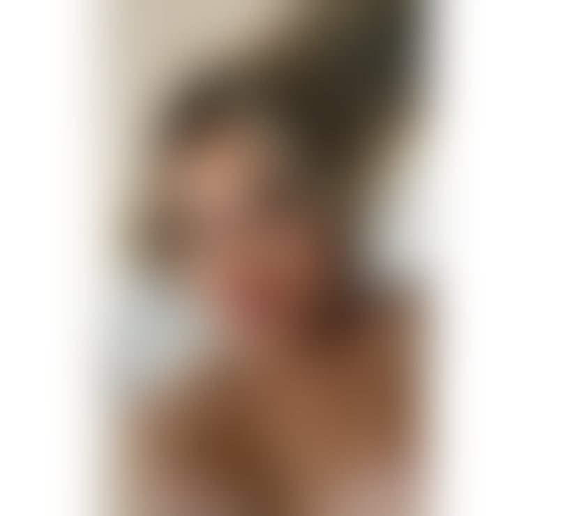 Trans Escorts Bristol Bristol City Centre - Bristol - Photos for CHLOE Fernandes