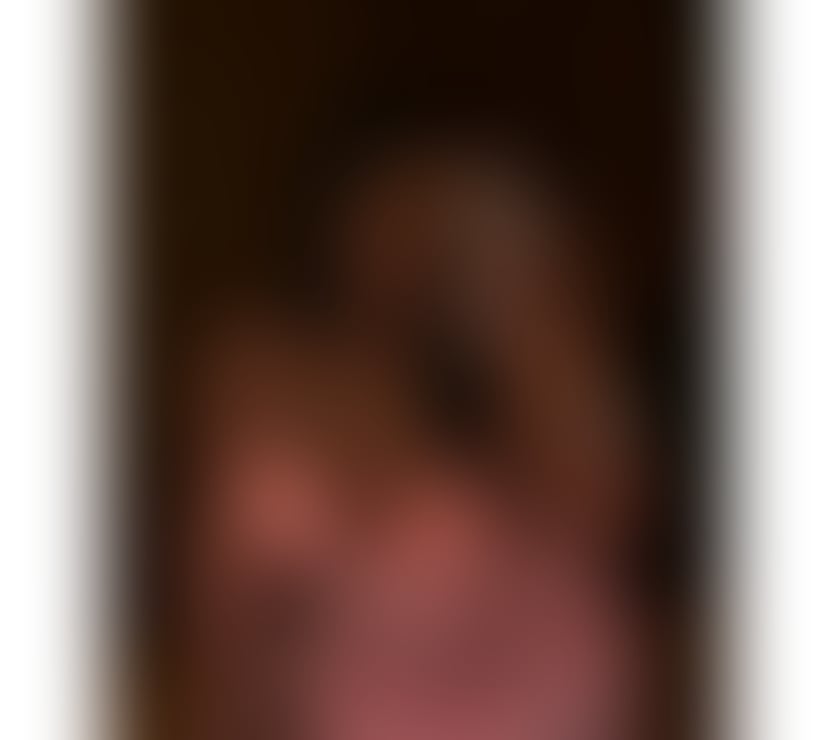 Escorts South East London Croydon - Photos for LUNA HOT EBONY BACK IN TOWN❤️‍🔥🫦