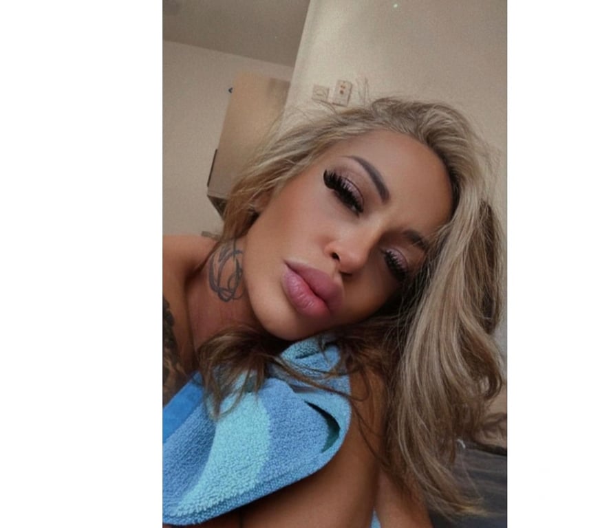 Escorts East London Hackney - East London - Photos for 🔥🍒🍒Cerry🍒🍒🔥